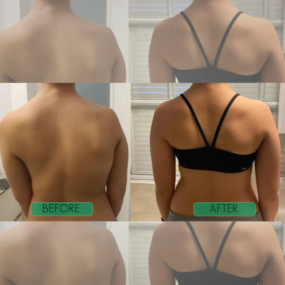 Alignra Instant Posture Corrector